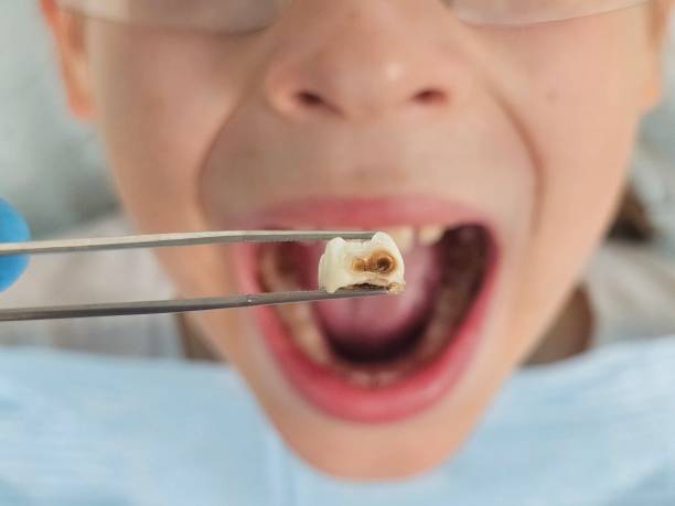 Best Emergency Dental Services for Seniors in Mcalmont, AR
