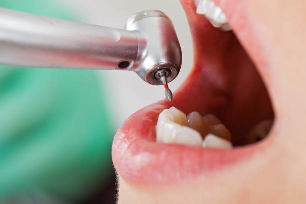 Best Weekend Emergency Dentist in Mcalmont, AR